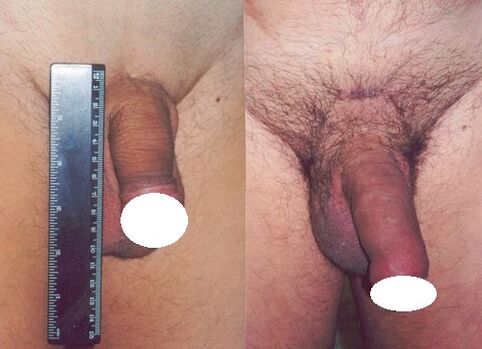 Pene antes e despois de aumentar